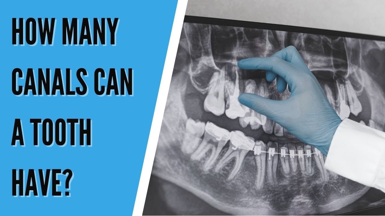 How many canals can a tooth have?