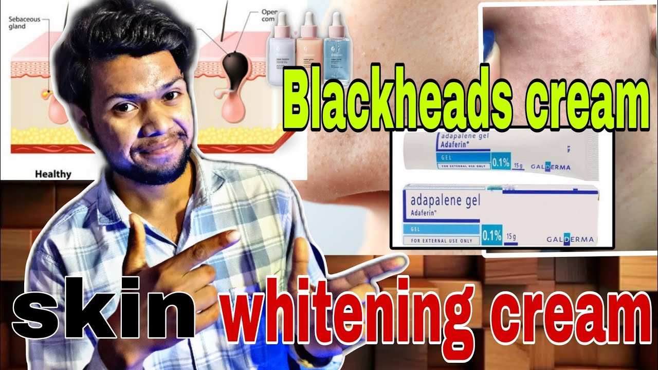Adapalene Gel Adaferin 0.1% Review In Hindi | Best Gel For Removing Blackheads and Whiteheads