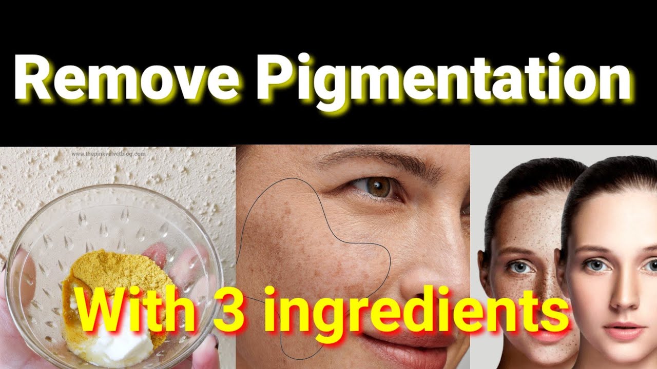 Remove Pigmentation, Dark Circles, Patches Pimples & dark skin 100