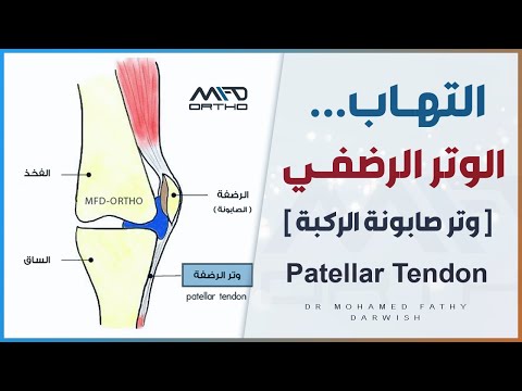 التهاب الوتر الرضفي في الركبة - Patellar Tendon | د. محمد فتحي درويش