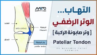 التهاب الوتر الرضفي في الركبة - Patellar Tendon | د. محمد فتحي درويش