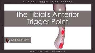 The Tibialis Anterior Trigger Point