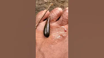 Leech Thiraphy Shorts Fun Youtube Big 