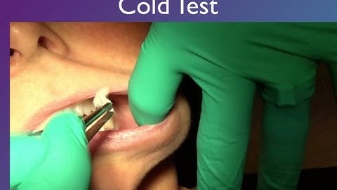 Clinical Testing Tips for Endodontic Diagnosis