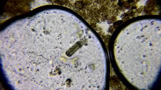 小中大前管蟲逃逃逃 Prorodon sp.