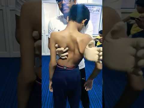 Scoliosis treatment