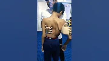 Scoliosis Treatment 