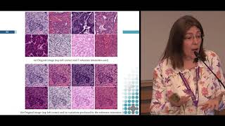 ECDP 2019 | Cross Entropy Segmentation Methods for Cell Nuclei in Histopathology