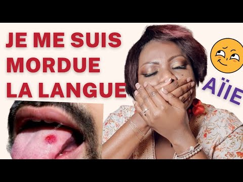 Vidéo: 4 façons de guérir une langue mordue