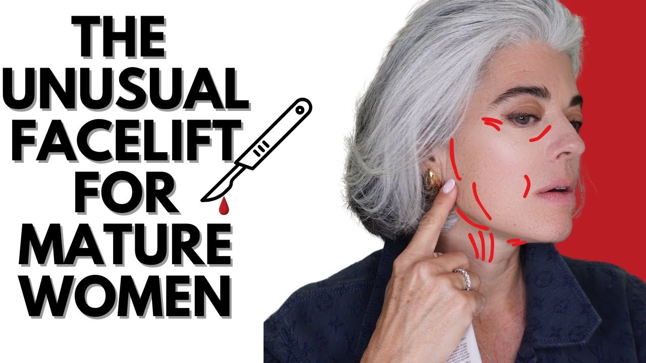 THE UNUSUAL FACELIFT WOMEN OVER 50 ARE FLOCKING TO
