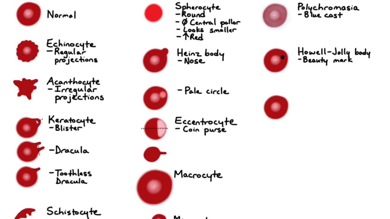Red Blood Cell Morphology Chart