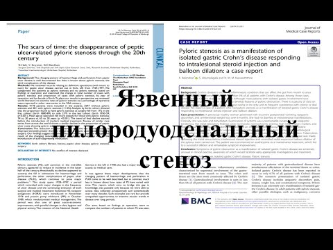 Хронические осложнения язвенной болезни желудка или ДПК. Пилородуоденальный стеноз