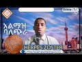 አልማዝ ባለጭራ ማንን ያጠቃል እንዴት ይታከማል How Is Herpes Zoster Treated Ethiotenacenter Ebstv Esatv አልማዝ ባለጭራ ማንን ያጠቃል እንዴት ይታከማል How Is Herpes Zoster Treated Ethiotenacenter Ebstv Esatv