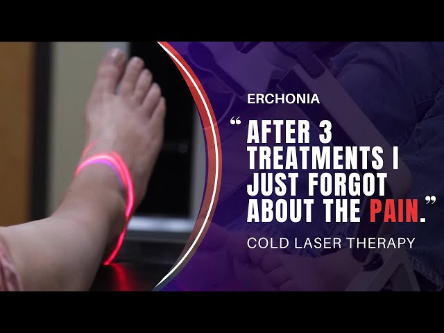 Erchonia Laser Therapy Testimonial | Plantar Fasciitis | FX 405