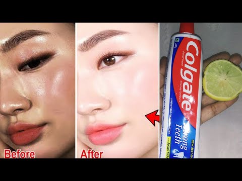Colgate toothpaste for face whitening | Lemon and colgate