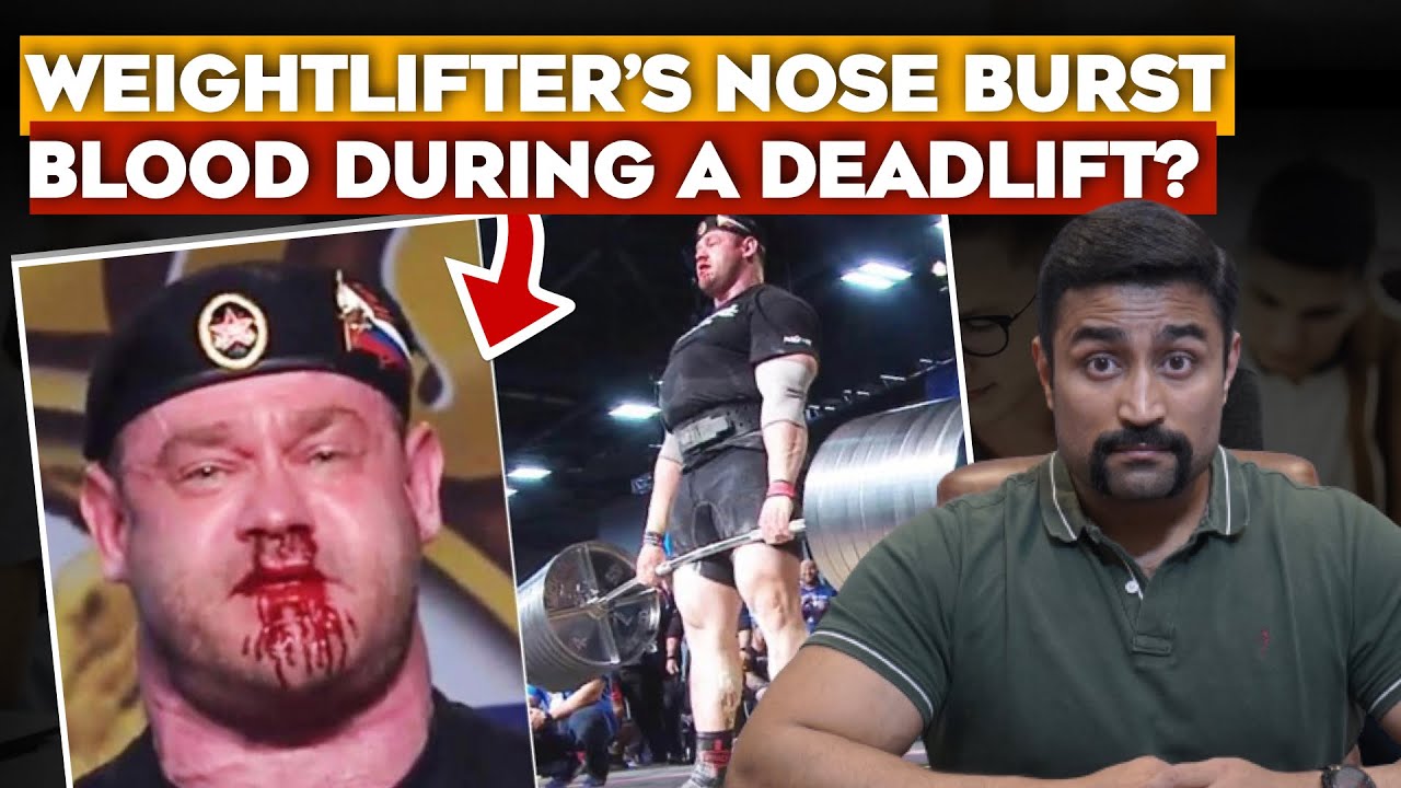 Nose Bleed during Deadlift ?? What to do ?? YouTube