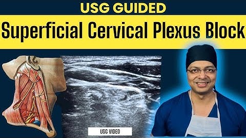 USG GUIDED SUPERFICIAL CERVICAL PLEXUS BLOCK | Cervical plexus anatomy | Real USG video of BLOCK.