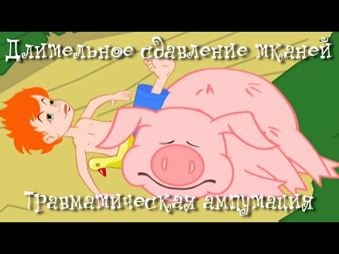 Длительное сдавление тканей. Травматическая ампутация - Неотложная помощь - Доктор Комаровский