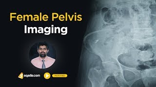 In-Depth Female Pelvis Imaging Lecture | Online Radiology Course for Medical Students | TRAILER