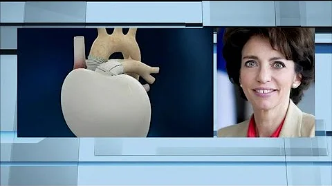 "Marisol Touraine": l'implantation d'un cœur artificiel, "une nouvelle formidable" - 19/12