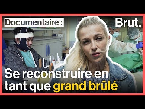 Julie Bourges Retrace Le Parcours D'un Grand Brûlé