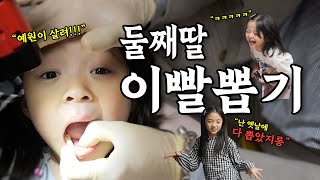 무자격 이빨뽑기 6년차 아빠! 집에서 둘째딸 이빨 뽑기🦷