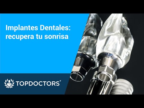 Implantes Dentales: recupera tu sonrisa