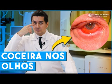 Olhos COÇANDO MUITO, O que pode ser?