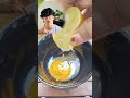 Dark Lips to Natural Pink Lips 💋at Home | Lip Lightening Remedy |Remove Lip Darkness Naturally #lips