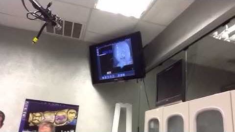 Intraoral Scan using E4D technology