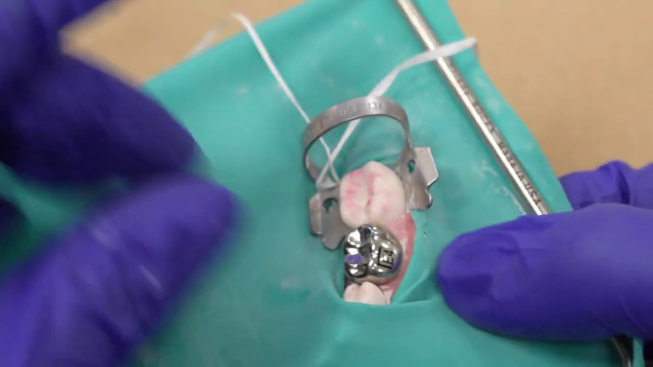 Stainless Steel Crown YouTube