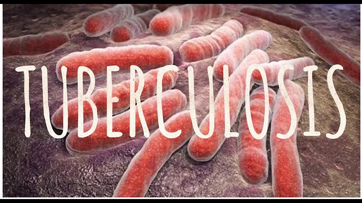 Tuberculosis | causes | mode of transmission | spread | types |clinical features and diagnosis |