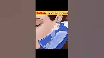 क न स फ करन क नय तर क Don T Use Ear Buds Medical Mitra 