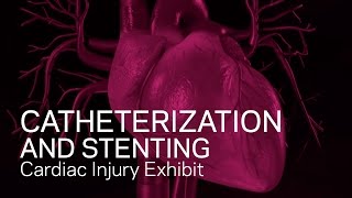 Cardiac Catheterization and Stenting