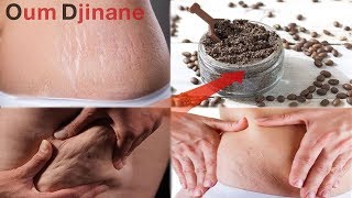 بملعقة قهوة واحدة تخلصي من خطوط الجسم الحمراء والبيضاء والسيلوليت وستختفي الى الأبد/Reduce cellulite