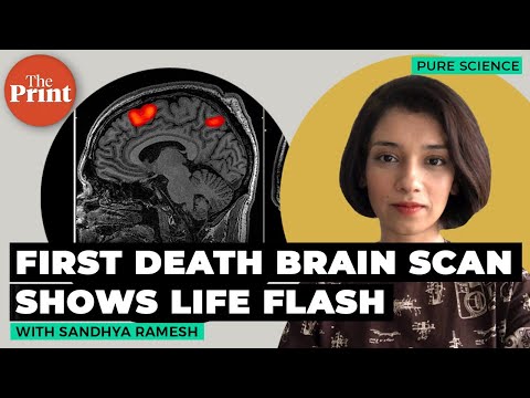 First scan of a dying human brain shows life flashes before eyes