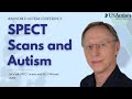 SPECT Scans and What They Can Uncover for Your Child on the Spectrum