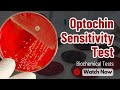 Optochin Susceptibility Test: Streptococcus pneumoniae Identification | Microbial Identification