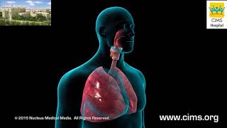 Bronchoscopy - CIMS Hospital