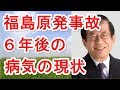 【武田邦彦】【ショック】福島原発事故から６年後の病気の現状（表あり）テレビでは絶対公表しません。【武田教授 youtube】