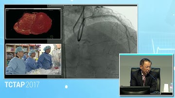 [TCTAP 2017] CTO Live - Live Case Session I