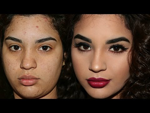 COMO OCULTO MIS IMPERFECCIONES DE ACNÉ Y MANCHAS / MAQUILLAJE SENCILLO PASO A PASO
