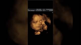 Retain and Attract Ultrasound Clients with Unique Pregnancy Keepsakes