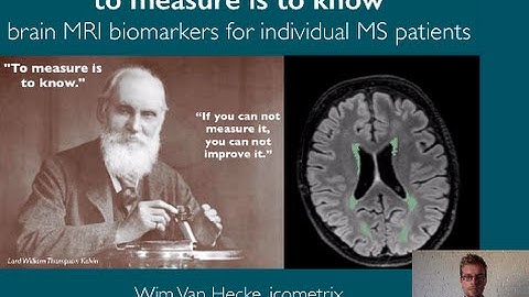 Brain MRI biomarkers in Multiple Sclerosis