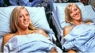 After the Surgery, Abby and Brittany Share Their New Lives