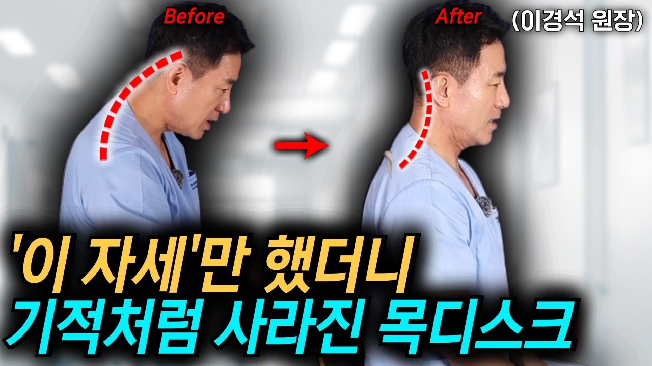 10초! 거북목 교정 루틴 !!수술없이 '이것'만 했는데 거짓말처럼 통증 사라진 기적같은 방법! l 이경석 원장 3화