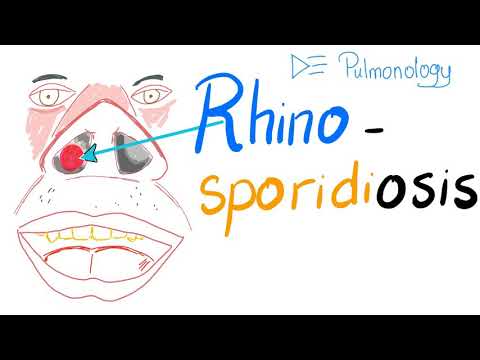 Video: Plesňové Infekcie (Rhinosporidiosis) U Psov