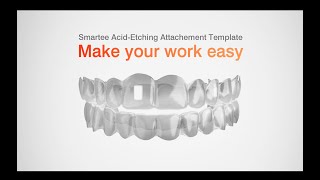Smartee Acid Etching Attachment Template