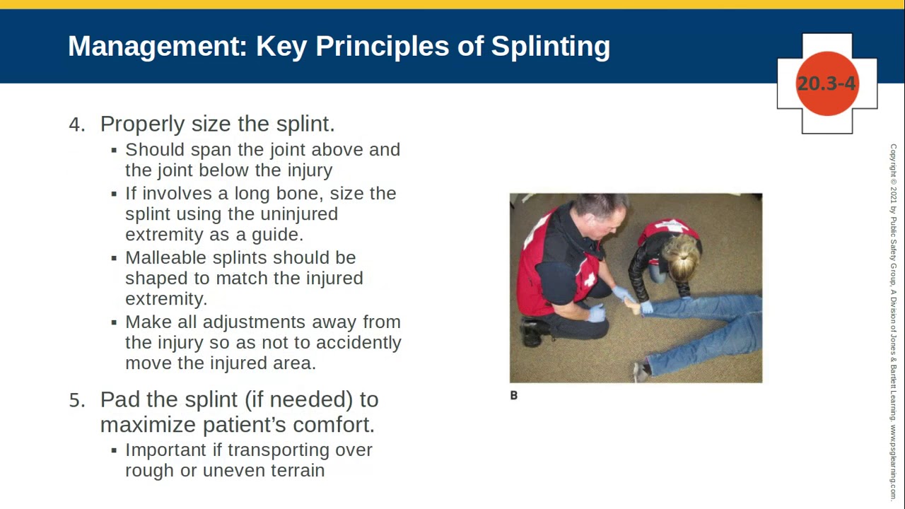 Chapter 20.3.3 General Splinting Principles - YouTube