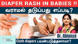 குழந்தைகளுக்கு Diaper  Rashes வராமல் எப்படி தடுப்பது?Baby  Diaper rash creams | Cloth diapers| Tamil
